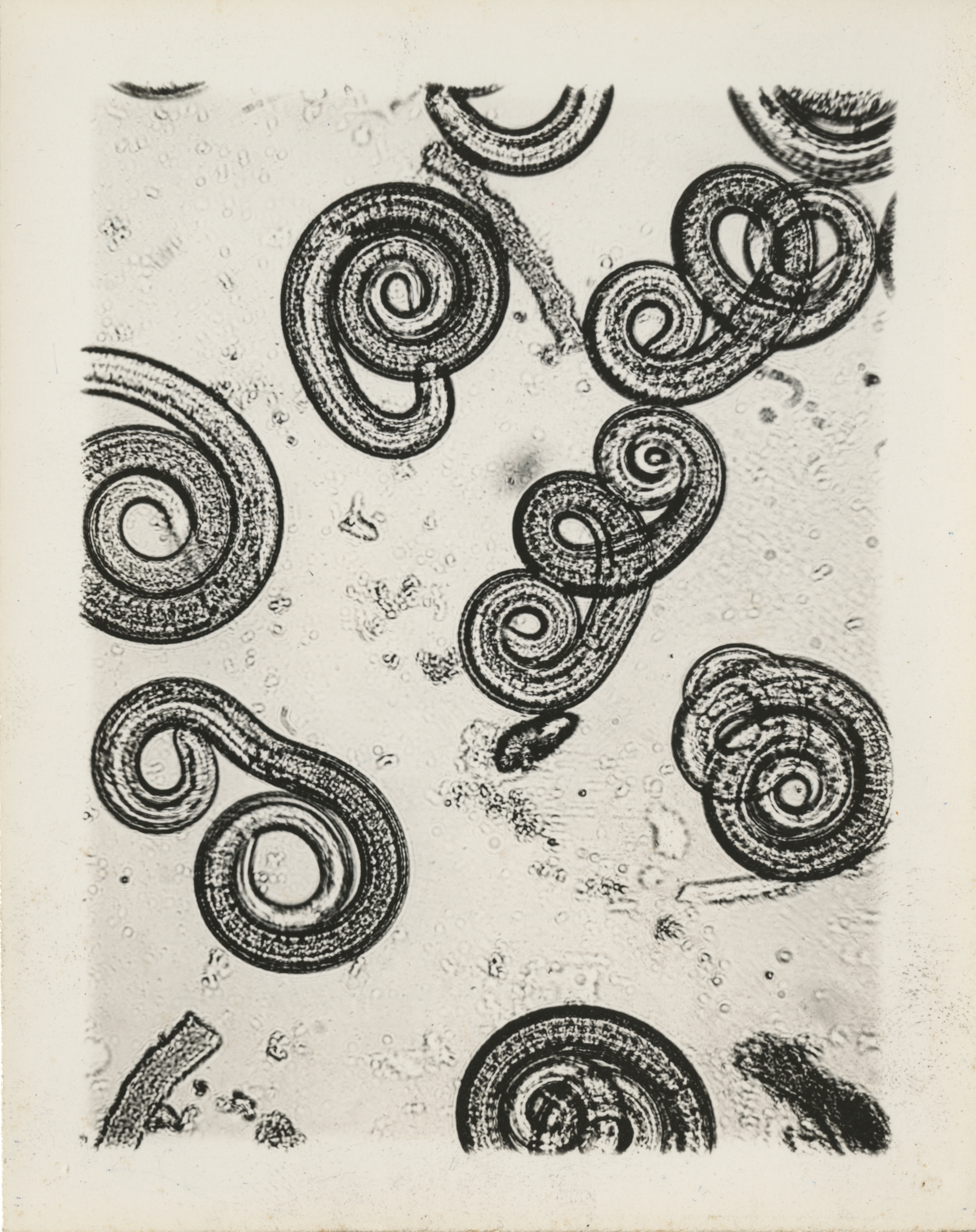 Личинки трихинеллы. Трихинелла (Trichinella spiralis).
